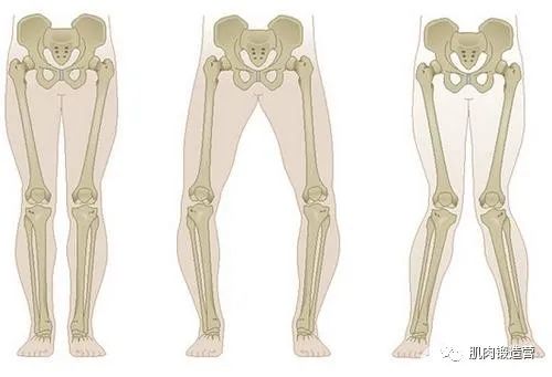 坚持3个训练动作，告别O型腿的困扰，走出更加精彩的人生