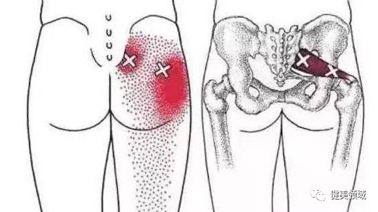 臀部腰部偶尔疼痛，可能是梨状肌综合征，做这些瑜伽动作可以缓解