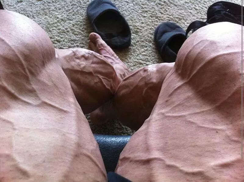 完美刻画腿部肌肉线条？快看看这2块小肌肉你练了吗？