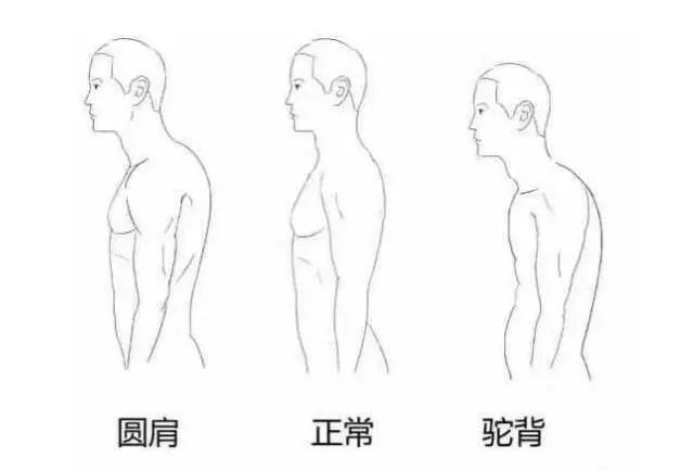 1个动作就可以改善你的体态，别让驼背影响了你的气质