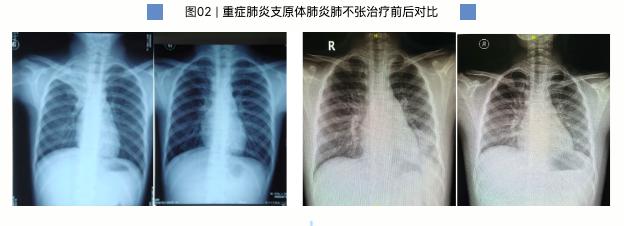 图源：复旦大学附属儿科医院官微