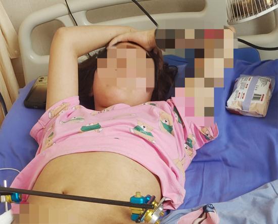 15岁的丹丹从KTV所在的三楼坠下后入院治疗。图片来源/受访者提供
